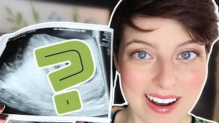 We Saw The Heartbeat! | Baby's First Ultrasound at 6 WEEKS! JAKS Journey [CC]