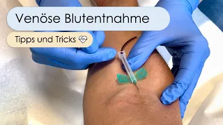 Blutentnahme: Mit 19 Tipps & Tricks zum Erfolg