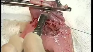 Хирургическая панкреатология