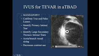 Contemporary Management of Acute Type B Aortic Dissection