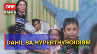 #OBP | 27-anyos na lalaki, naging bedridden dahil sa hyperthyroidism