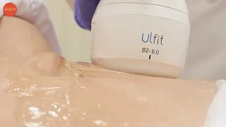 Ультразвуковая липосакция ULFIT