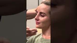 1 week post op rhinoplasty! Gorgeous women with gorgeous results!