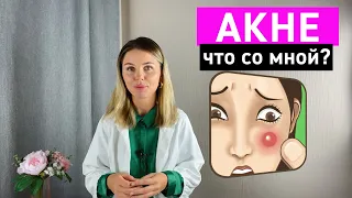 Акне: что со мной? Виды прыщей. Проблемная кожа