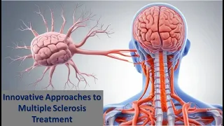 Innovative Approaches to Multiple Sclerosis Treatment