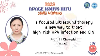 Prof. Li Chengzhi-Is focused ultrasound therapy a new way to treat high-risk HPV infection and CIN