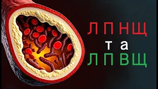 Підвищенний холестерин. ЛПНЩ та ЛПВЩ