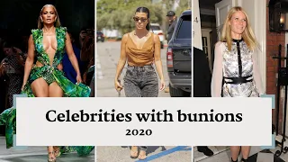 Celebrity feet: Celebrities with bunions | Calla Shoes