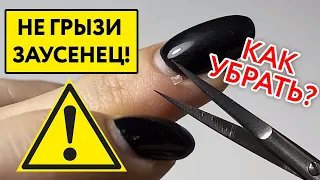 Ошибки домашнего маникюра: заусенец на пальце и боковые валики ногтя