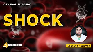 Shock | General Surgery Lecture | USMLE V-Learning Platform | sqadia.com