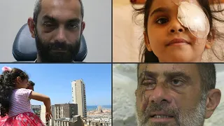Tuertos y traumatizados: testimonios de sobrevivientes a la explosión en Beirut | AFP