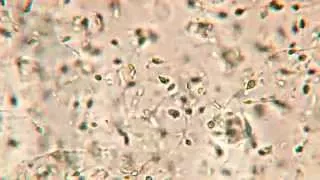 Human sperm under the high resolution digital microscope