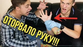 1000 РЕЗИНОК НА РУКУ!? ОТОРВАЛО РУКУ!!! Rubber Band CHALLENGE