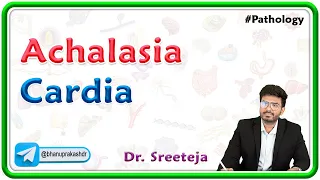 3. Achalasia Cardia | USMLE Step 1 Pathology