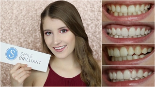 How To Whiten Teeth At Home + Giveaway! | Smile Brilliant