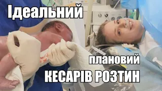 ІДЕАЛЬНИЙ ПЛАНОВИЙ КЕСАРІВ РОЗТИН. Історія пологів. Як спланувати пологи? Другий раз краще. Роди!