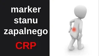 CRP - C-reactive protein - a marker of inflammation