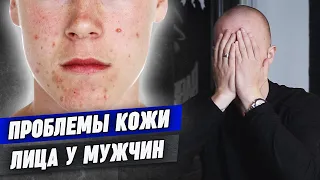 Мужской уход за лицом / Проблемы с кожей лица у мужчин / Как определить тип кожи лица?