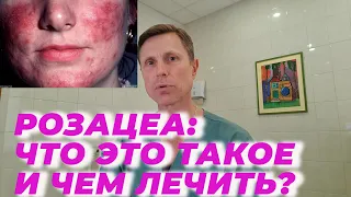 Розацеа: что это такое и чем лечить.