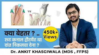 क्या बेहतर ? .. रूट कनाल ट्रीटमेंट या दांत निकलवा देना ? Root canal treatment v/s Tooth extraction