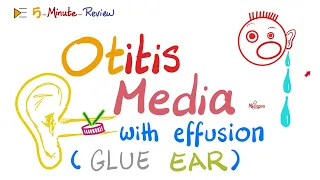Otitis Media with effusions (Glue Ear 👂)