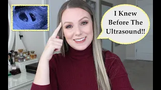 Early Signs Of Twin Pregnancy | How I Knew!