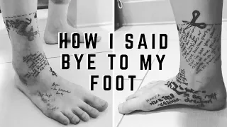 COME WITH ME ON A GOODBYE TOUR TO MY LEG BEFORE AMPUTATION! [how i said bye to my foot] [CC]