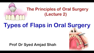 Types of Flaps in Oral Surgery | Syed Amjad Shah