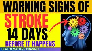 Warning Signs of Stroke 14 Days Before it Happens. MUST KNOW the Stroke Symptoms in Women and Men.