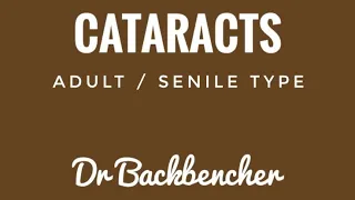 Adult Cataracts - Causes, symptoms, complications and treatment - Ophthalmology Lectures