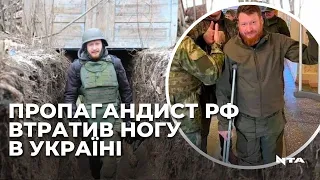 російський пропагандист втратив ногу, бо наступив на війні на російську міну