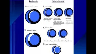 Internal Medicine Grand Rounds:  Advanced Cardiac Imaging - What the Internist Should Know