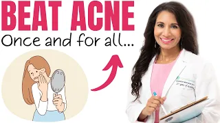 Adult Acne Epidemic: What You Need to Know to Get Rid of HORMONAL Acne - Once and for all! | Dr. Taz