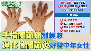 手指關節痛別輕忽 退化性關節炎好發40~50歲女性 健康2.0