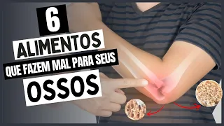 CUIDADO!🚨 ESSES 6 ALIMENTOS ESTÃO DESTRUINDO SEUS OSSOS!