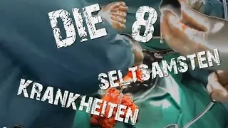 DIE 8 SELTSAMSTEN KRANKHEITEN