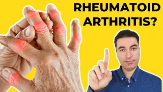 How to cure RHEUMATOID ARTHRITIS? Discover the best natural remedies...