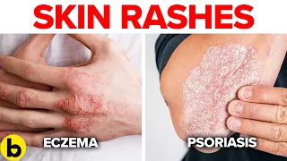 6 Reasons You’re Getting Skin Rashes