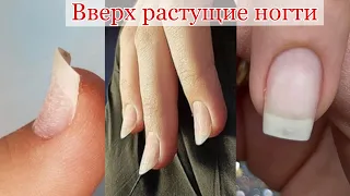 Как скрыть вверх растущие ногти/Как сделать кожу блестящей