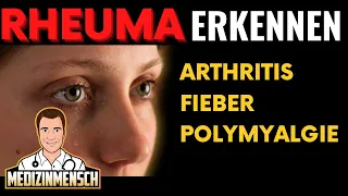 Rheuma: Symptome von Arthritis, Fieber, Polymyalgia Rheumatica (Rheumatologe erklärt)