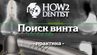 Как перевести цементную фиксацию в винтовую / How to Dentist
