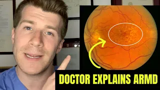 Doctor explains Age-related Macular Degeneration (AMD/ARMD) including dry and wet types