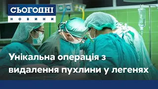 Ракова пухлина у легенях: українські лікарі провели унікальну операцію