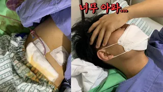 I almost died due to a burst appendix. : After appendix surgery