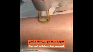 ليزر إزالة الشعر | Laser hair removal