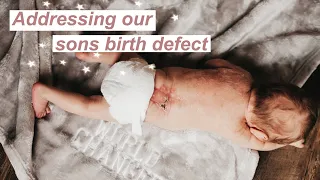 WHAT IS SPINA BIFIDA? | Answering Your Questions About Our Sons Birth Defect