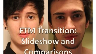 FTM transgender transition timeline: slideshow and comparisons (nearly 3 years on T)