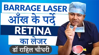 Barrage Laser |  Laser for Retina Holes and Lattice