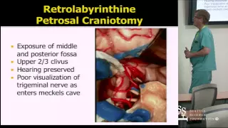 Petrosal Craniotomy by Johnny Delashaw, M.D