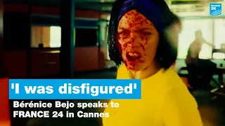 'I was disfigured,' Bérénice Bejo of ‘Final Cut’ tells FRANCE 24 in Cannes • FRANCE 24